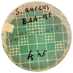 Antibacterial-elimination-diameter-62mm